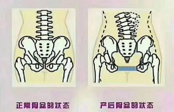 藍絲帶盆底肌修復大概需要多少錢？